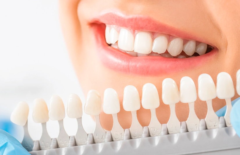 ¿Cómo Funciona el Blanqueamiento Dental?